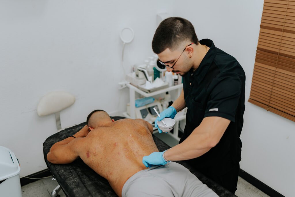 dacio para peeling de espalda acne